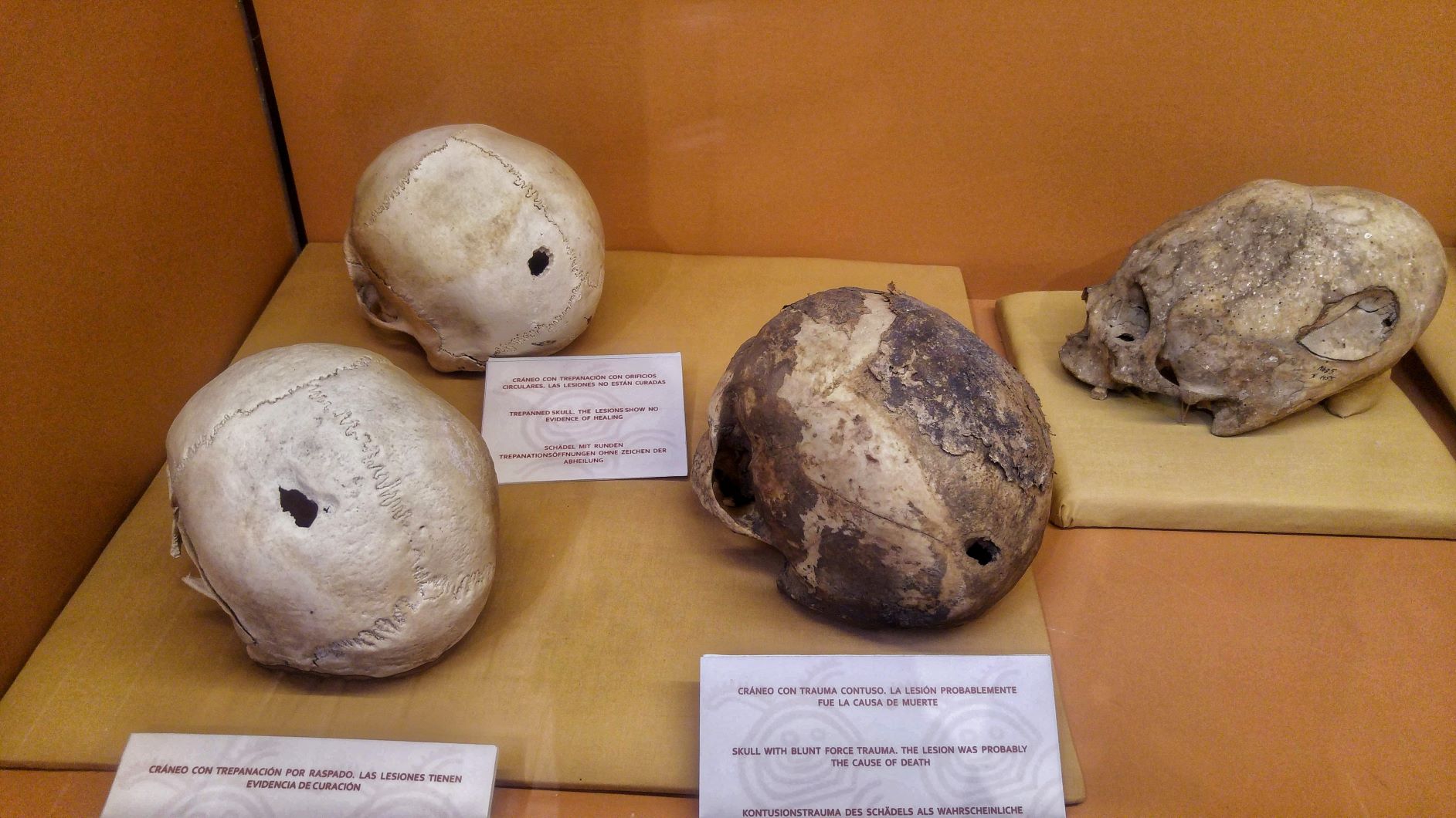 Discovering Peru Mummies in the Leymebamba Museum